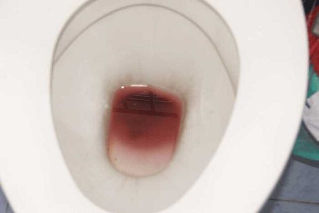 spots on men when excited